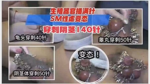 重口变态系列！胆小勿进，生殖器官被插满针，SM性虐变态穿针140针！_ title=_重口变态系列！胆小勿进，生殖器官被插满针，SM性虐变态穿针140针！