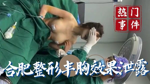 合肥整形丰胸效果流出